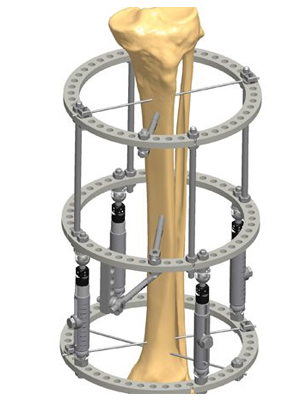 Deformity Correction Specialists